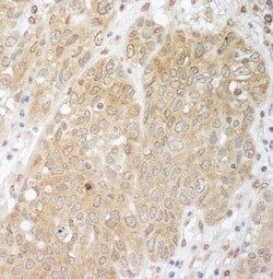 CBLB Antibody, Novus Biologicals 0.1mg; Unlabeled:Antibodies, Polyclonal